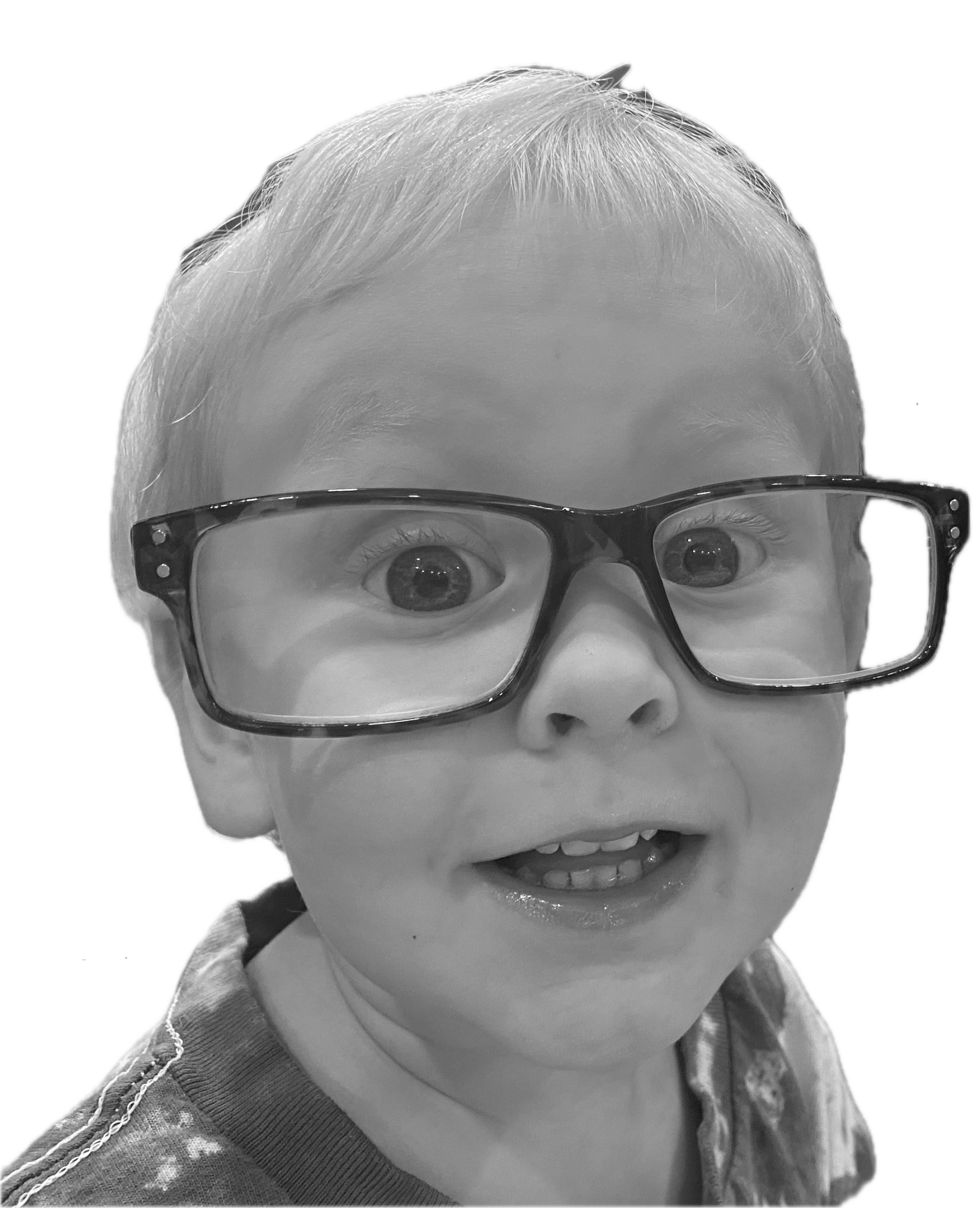 Child wearing large glasses, surprised expression.